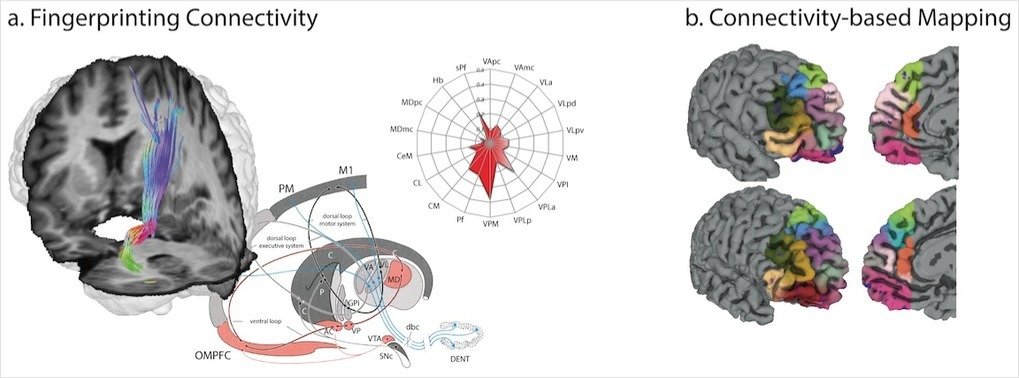 <strong>Fig. 1. Diffusion tractography-based fingerprinting is an emerging method enabling insight into individual connectional, and thus, functional parcellation of cortex and subcortical grey matter using non-invasive MR imaging in living human subjects.</strong><span> These methods may be applied (A) to quantify specific fibre connections </span><em>in-vivo</em><span> or (B) to derive connectivity-based parcellations of brain maps.</span>