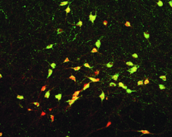 MCH-Nervenzellen regulieren das Energiegleichgewicht des Körpers. Im Bild zu sehen sind angefärbte MCH-Nervenzellen im Hypothalamus der Maus.
