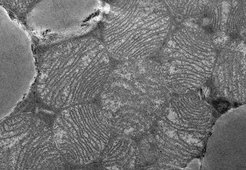 The long, non-coding RNA H19 influences the formation and function of brown fat cells. Picture: Brown adipose tissue.