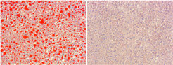 Links: Bei einer sehr fettreichen Ernährung lagern sich Fette in der Leber ein (rot). Dies kann zur Entstehung einer Fettleber und zu Diabetes führen. Rechts: Bei einer Inaktivierung der Ceramid Synthase 6 sind die Mäuse trotz der fettreichen Ernährung vor der übermäßigen Einlagerung von Fetten in die Leber geschützt. Insbesondere der Zuckerstoffwechsel der Mäuse wird dabei verbessert.
