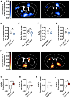 Brain scans show differential activity levels in various regions under different conditions.