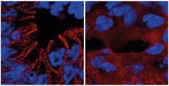 Links: In gesunden Mäusen wird das rot markierte Protein (Desmoplakin) von den Darmzellen in Desmosomen eingebaut. Rechts: Bei einem fehlerhaften Insulinsignalweg bleibt das Protein im Zellplasma. Dadurch können keine Desmosomen gebildet werden und die Darmbarriere wird geschwächt.