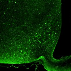 Nociceptin neurons in the arcuate nucleus of the hypothalamus.
