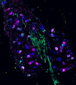 Fluorescence microscopy image of genetically distinct neurons in the nodose ganglion.