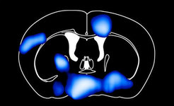 CT-Scan eines menschlichen Kopfes mit blauen Bereichen.