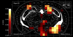 Brain map with color-coded activation areas.
