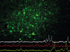 The image show nerve cells in green under the microscope.