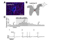 POMC neurons overview
