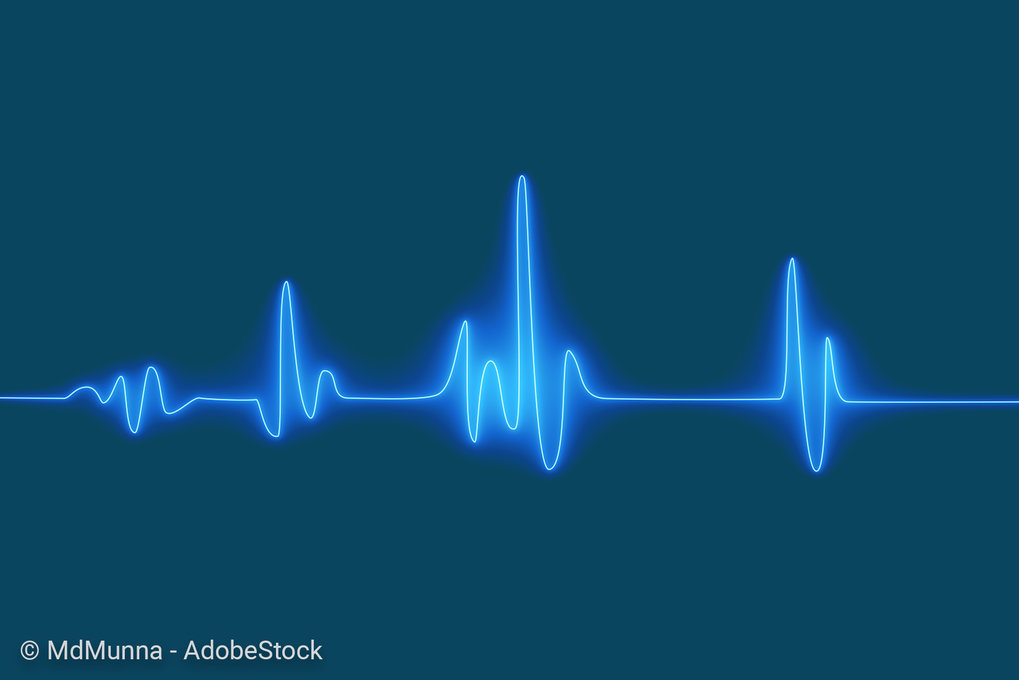 Bright blue ECG waveform on dark teal backdrop, showcasing heart activity.