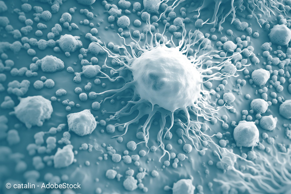 How is obesity linked to cancer?