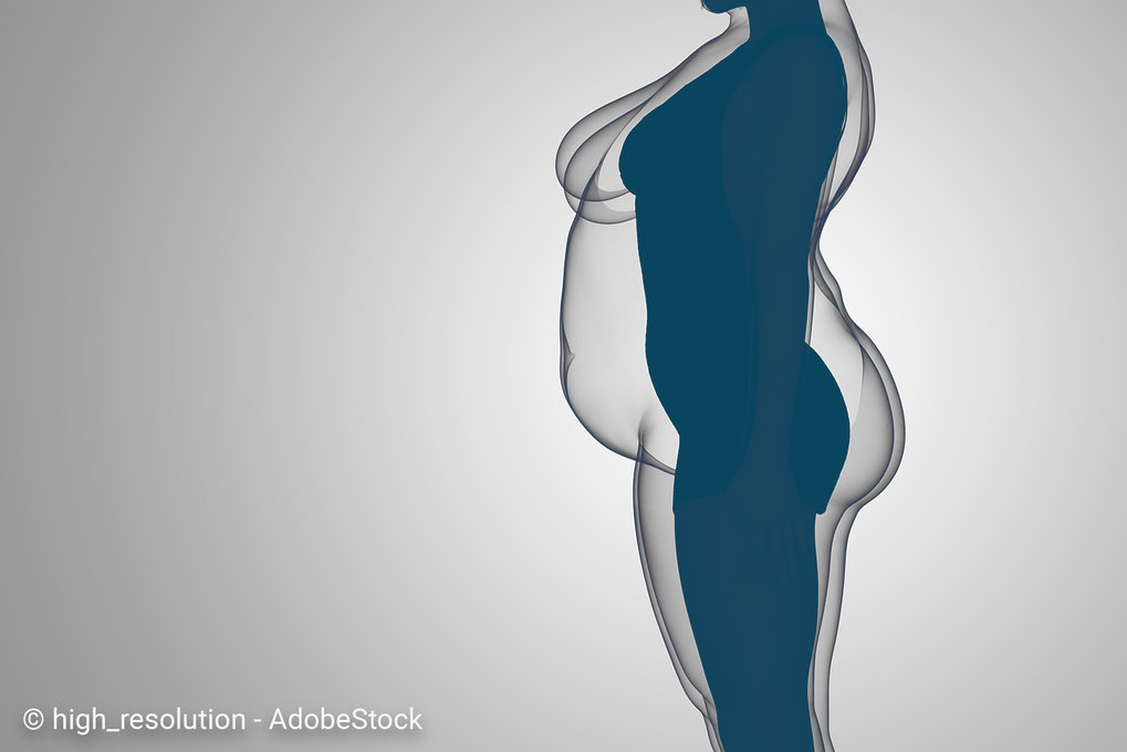 Why are more people becoming obese?